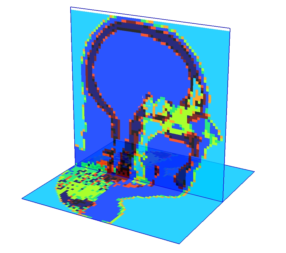 skull-ct1.jpg
